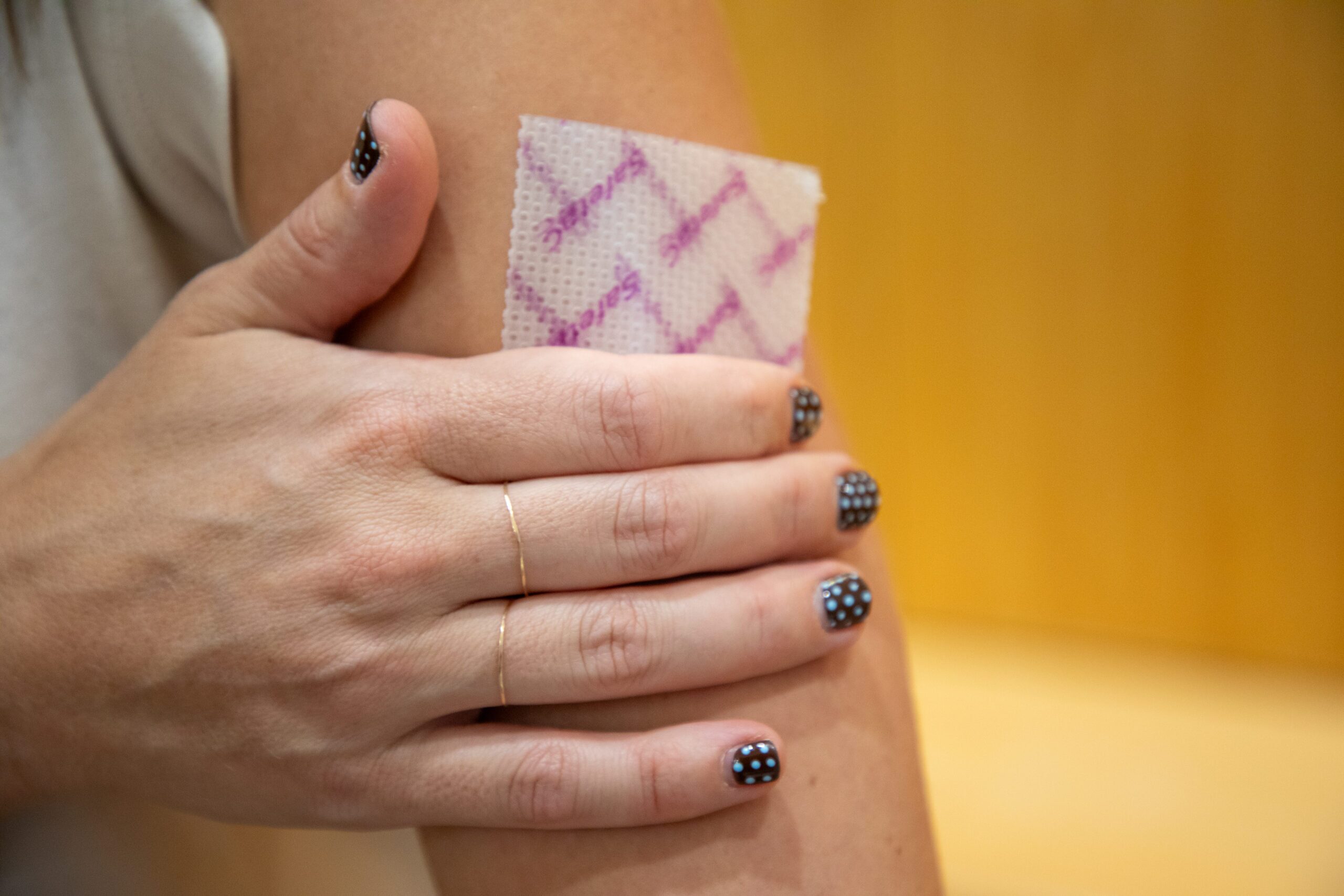 A person showing a nicotine patch on their upper arm, with polka-dotted painted fingernails.